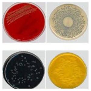 Potato Flake Agar Culture Monoplate Deep Pour 10/Pk