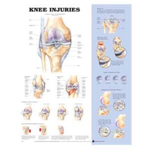 Knee Injuries Anatomical Chart 20x26" Each