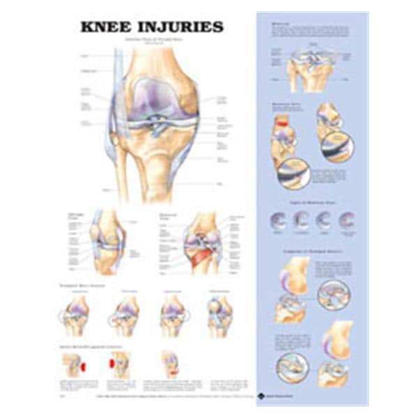 Knee Injuries Anatomical Chart 20x26" Each