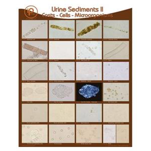 Urine Sediments II Wall Poster 19x24" Each