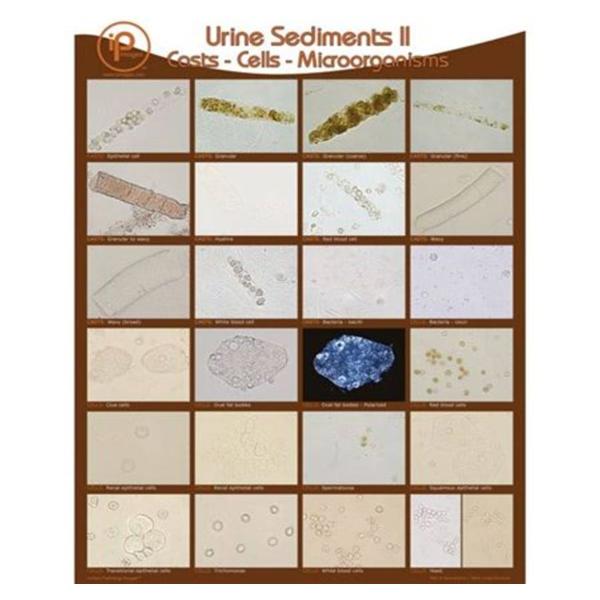 Urine Sediments II Wall Poster 19x24" Each