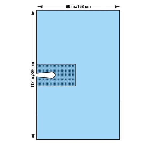 KC100 112x60" Sterile Surgical Drape Fenestrated
