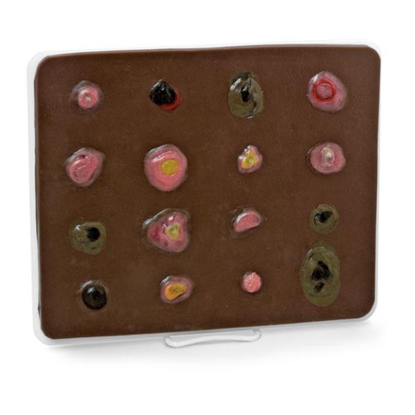 Life/form Enlarged Skin Cancer Educational Trainer 8-1/2x11x1/4"...