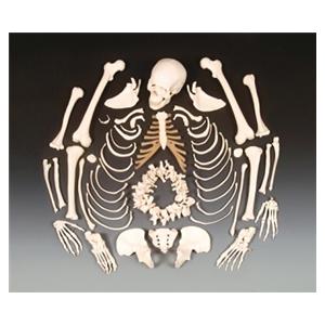 Disarticulated Skeleton Anatomical Model With Stand/Detachable He...
