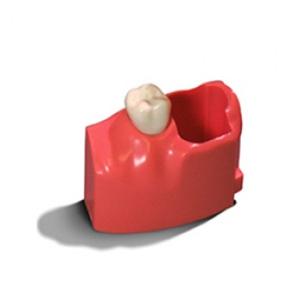 Acadental Teeth 12-15 MEL Model Left Each