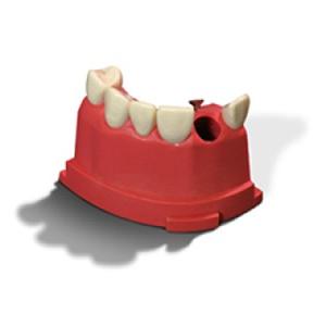 Acadental Teeth 07-12 M200 Model Right Upper Anterior Each
