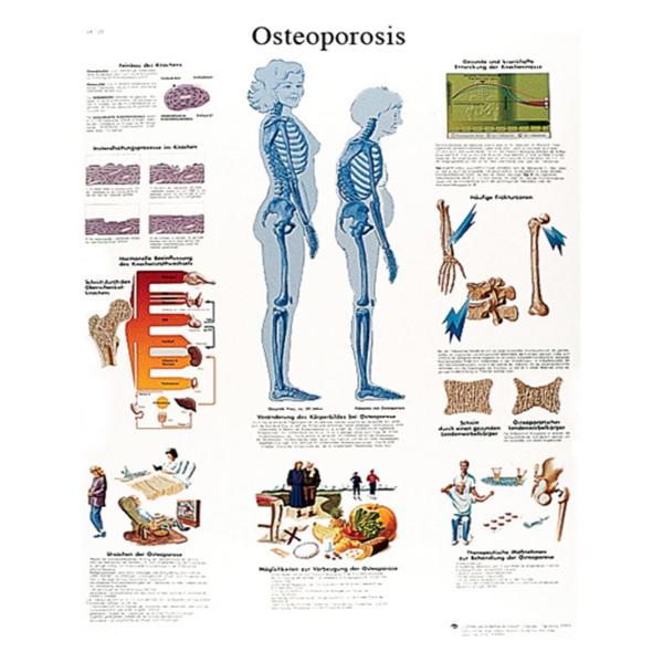 Spinal Column 20x25" Anatomical Chart Ea