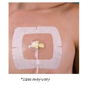 SecureView Port Film IV Dressing 5-1/2x6-1/2" Adhesive Non-Adhere...