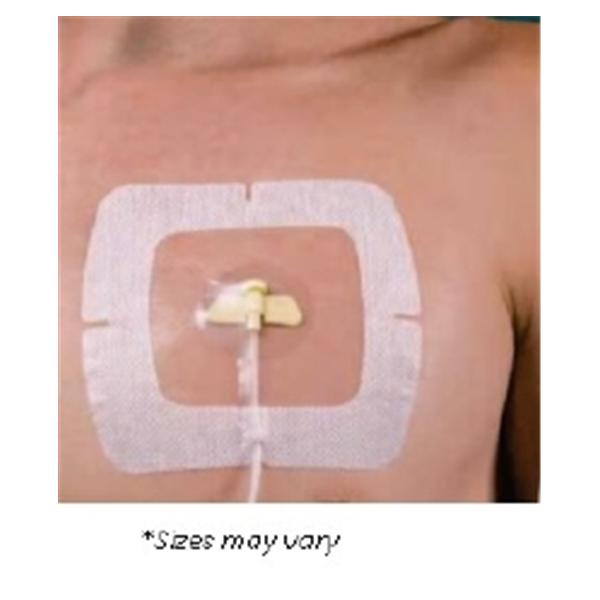 SecureView Port Film IV Dressing 5-1/2x6-1/2" Adhesive Non-Adhere...