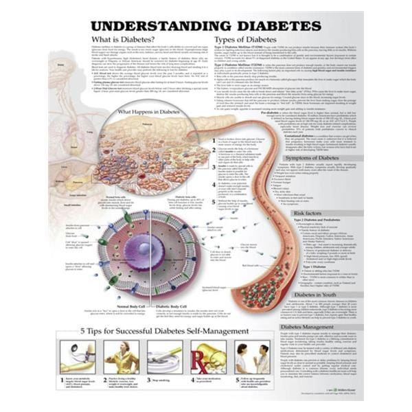Understanding Diabetes Educational Chart 20x26" Each