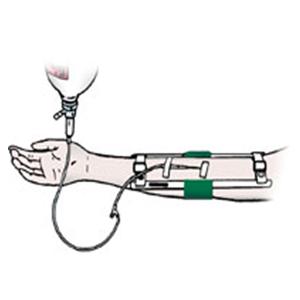Immobilizer Elbow 7" Universal