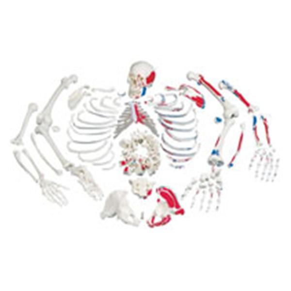 Disarticulated Skeleton Ea