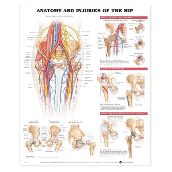 Injuries of the Hip Anatomical Chart 20x26" Each