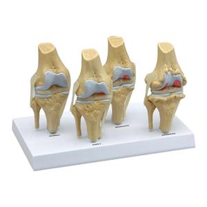 Knee Anatomical Model 1-3/4x3x5-1/2" 3/4 Scale Each