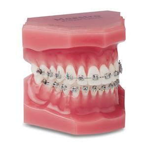 Maestro® Mini-Twin® Roth Rx Bracket .018 LL4 -17T 0A 4DO 10/Pk