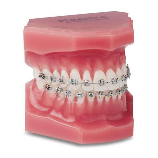 Maestro® Mini-Twin® Roth Rx Bracket .022 UR1 12T 5A 0O 10/Pk