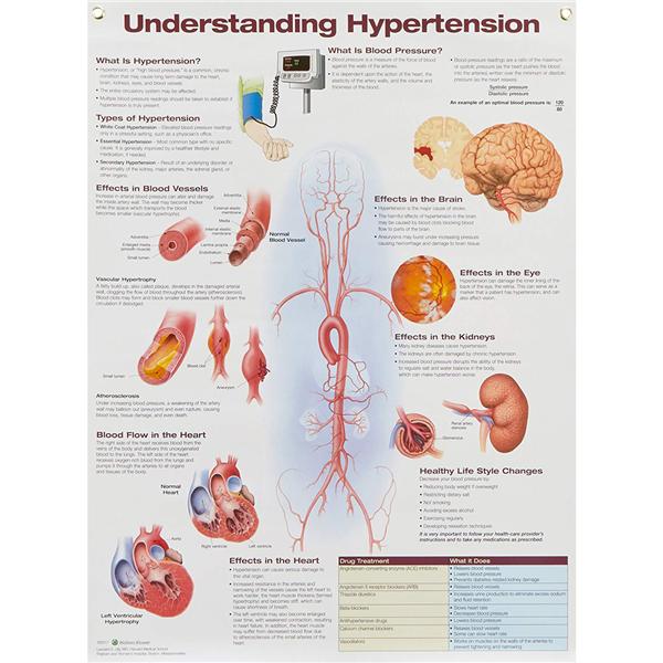 Understanding Hypertension Laminated Wall Chart 20x26" Hypertensi...