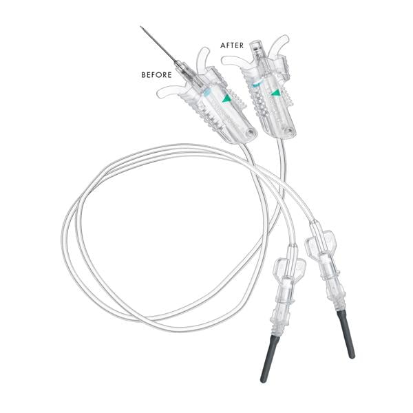 VanishPoint Blood Collection Set 21g 3/4" Dark Green Safety 12" T...