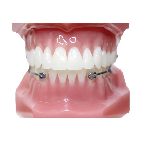 Carriere Motion 3D Class III Typodont Ea