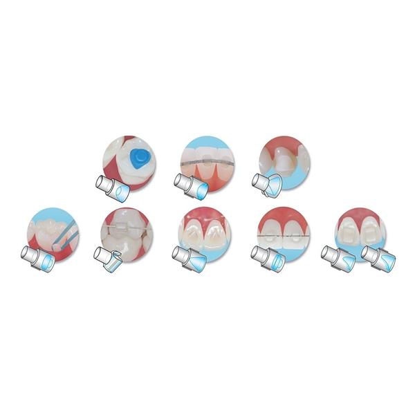 Mini-Mold Molar Pad Tips Posterior 10/Pk