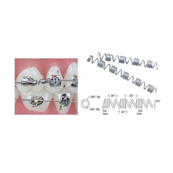 TruFlex Distalizing Spring Nickel Titanium 7 in 0.010 in x 0.045 in 3/Pk