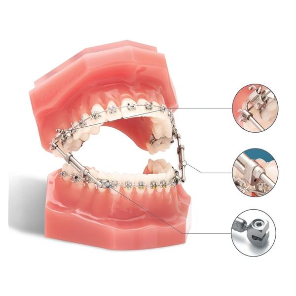 TruEase Bite Corrector 2/Pk