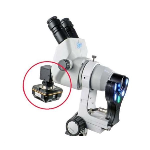 Camera Colposcope