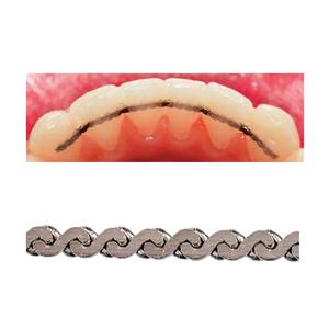 FlexTech Retention System Ea