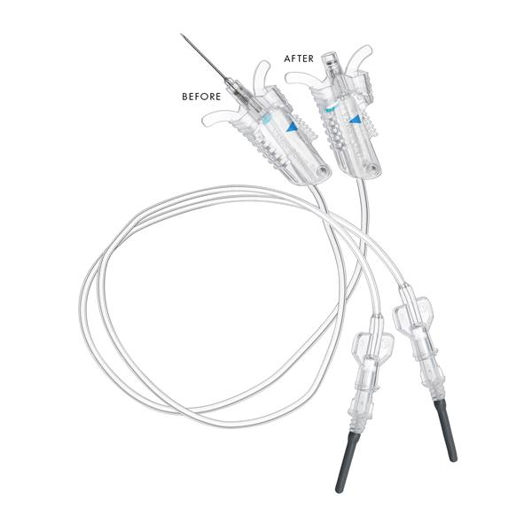 VanishPoint Blood Collection Set 23gx3/4" 12" Safety 200/Ca