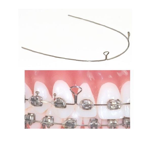 TruForce 2 Keyhole Retraction Archwire SS Anterior 0.016 in x 0.022 in 10/Pk