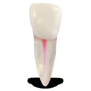 Real-T #8/Central Incisor/Maxillary Right Endo/Practice Tooth Ea