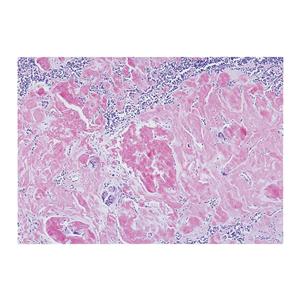 Amyloid Stain Kit Ea Ea