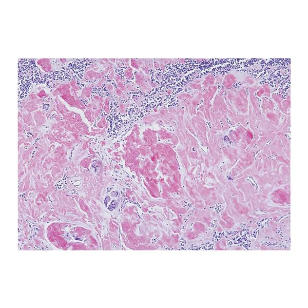 Amyloid Stain Kit Ea Ea