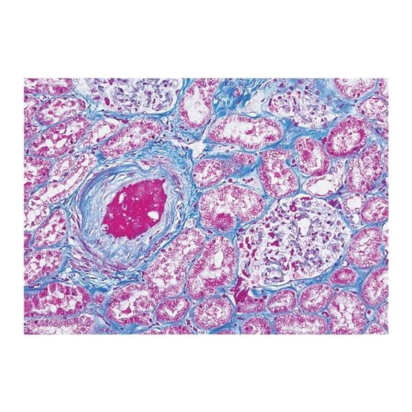 Masson's Trichrome Stain Kit Each