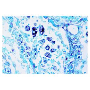 Periodic Acid Solution 1% 125mL Ea