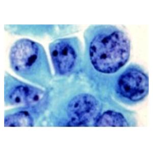 Wright-Giemsa Stain For Treating Stains Bottle 1/Ca