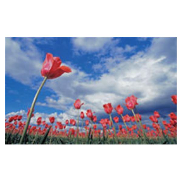 CeilingScenes Acoustic Tile Tulip Field 2-Tiles Vertical 48 in x 24 in Ea