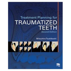 Book Treatment Planning for Traumatized Teeth 2nd Edition Ea