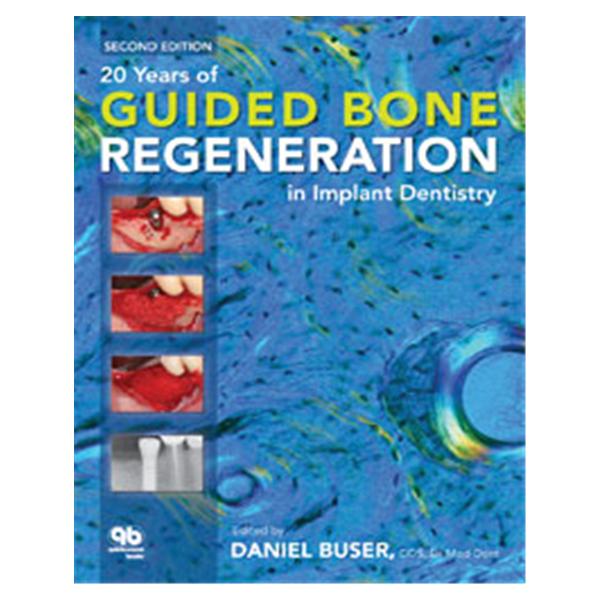 Book 20 Years of Guided Bone Regeneration in Implant Dentistry 2nd Edition Ea