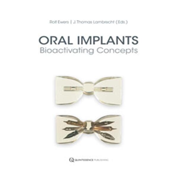 Book Oral Implants: Bioactivating Concepts Ea