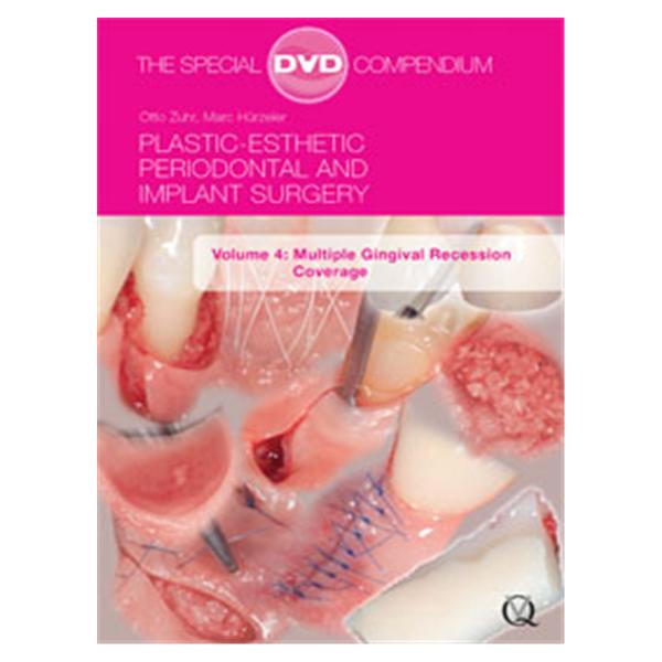 DVD Plstc-Esth Perio&Imp Srgry: Mltpl Gngvl Rcssion Cvrg Volume 4 Ea