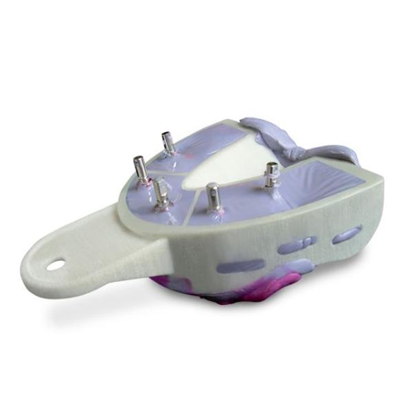 Miratray Implant Advanced Double Arch Impression Tray L3 Large Lower 6/Bx