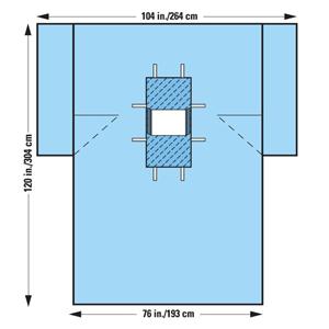 104x76x120" Sterile Laparotomy/Cholecystectomy Drape 12x13" Fenes...