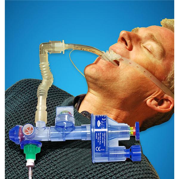 SureVent Emergency Oxygen Ventilator