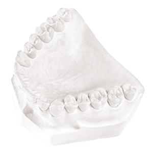 Lab Plaster Type II White 0.19% Fast 25Lb/Bx