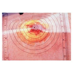 Measuring Sheet For Wound 250/Box