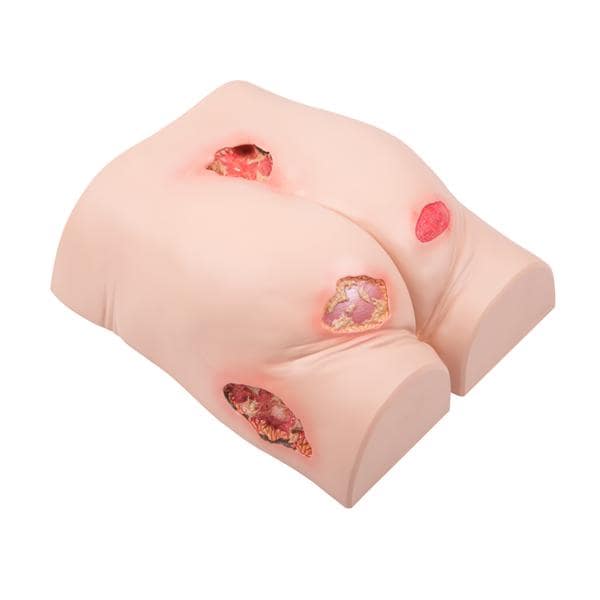 3B Scientific Decubitus Wound Care Trainer Model Ea