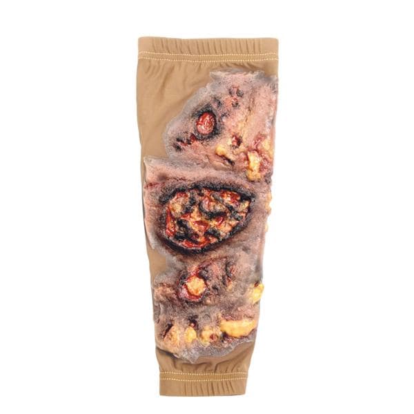 STOPS Medical Lower Leg Skin Burn Sleeve Ea