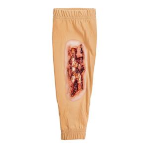 STOPS Medical Radial/Ulna Fracture Leg Sleeve Ea