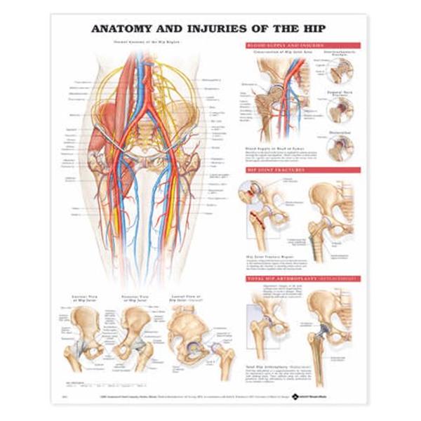 Anatomy and Injuries of the Hip Anatomical Chart 20x26" Flexible...